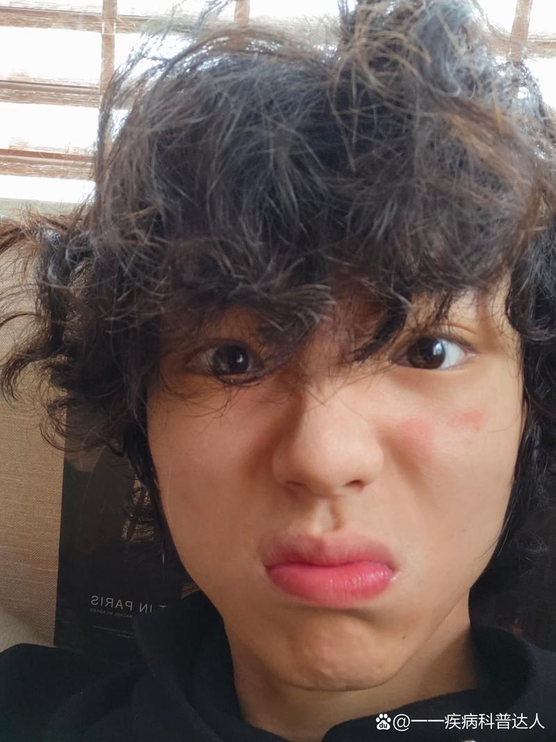 呼吸37度洗面奶过敏