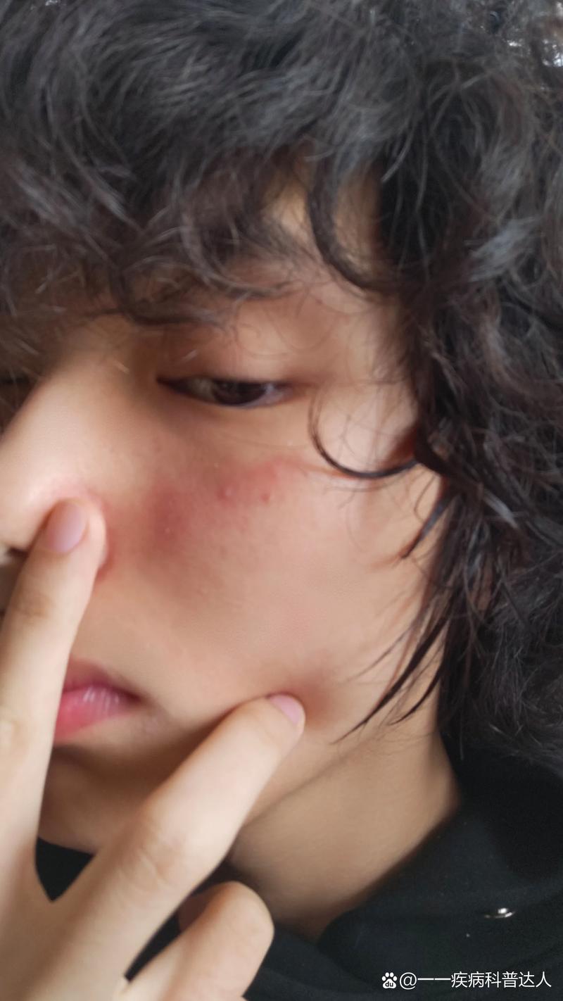 呼吸37度洗面奶过敏