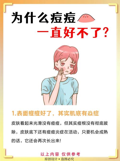 为什么会起痤疮