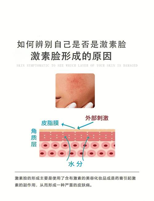 怎么判断护肤品有没有激素