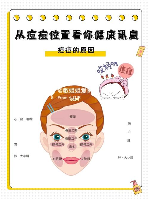 鼻子起痘痘什么原因