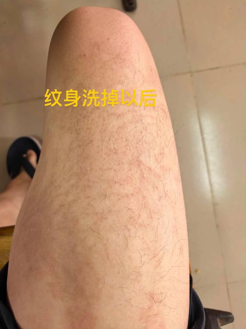 纹身用什么可以洗掉