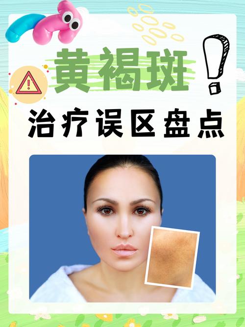 黄褐斑看什么科