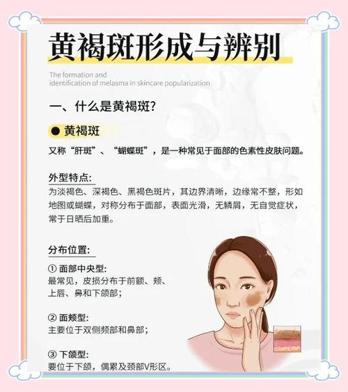 黄褐斑看什么科