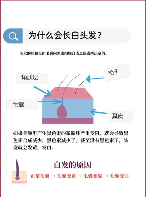 头发白是什么引起的