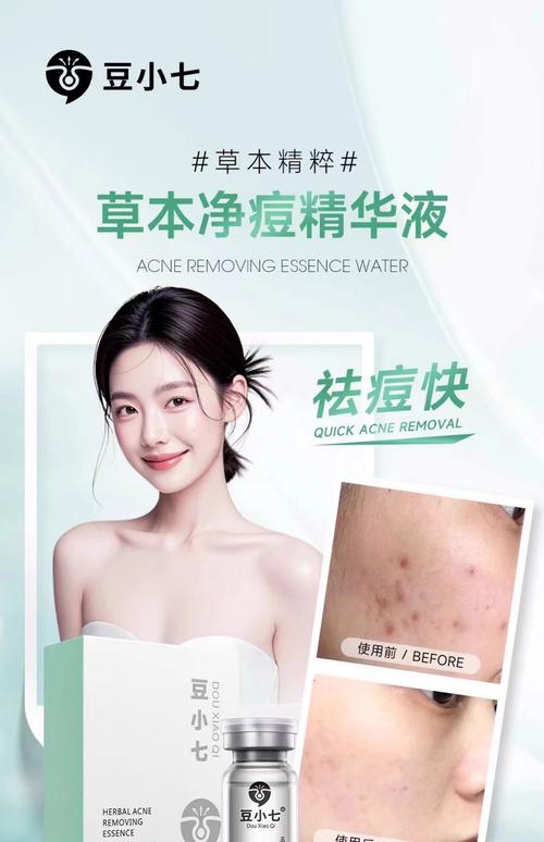 脸上长痘痘用什么护肤品好