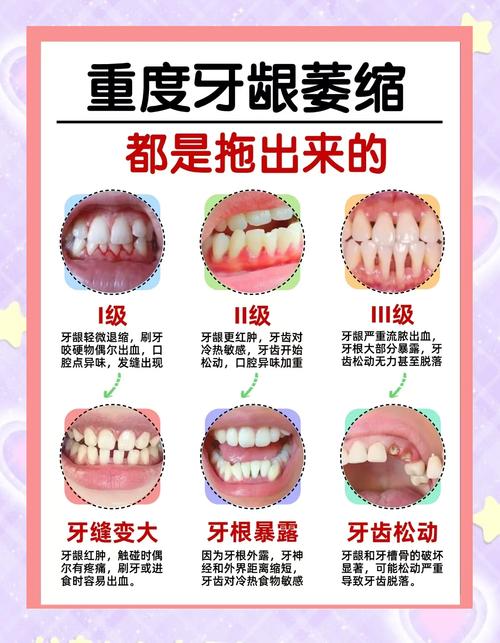 牙龈萎缩什么症状