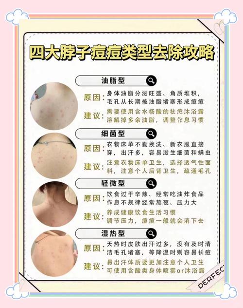 脖子为什么会长痘痘