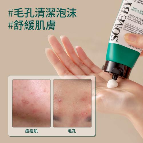 有痘痘能用磨砂洗面奶