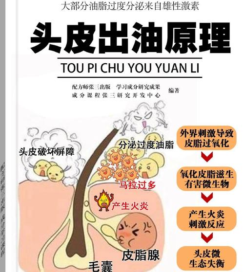 头皮出油是什么原因