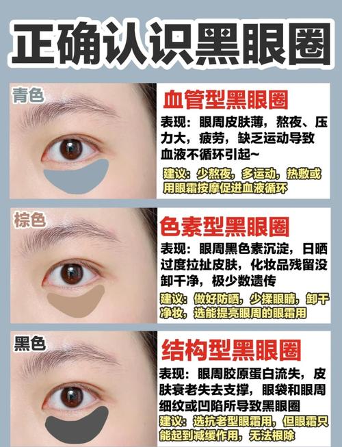 什么可以遮黑眼圈