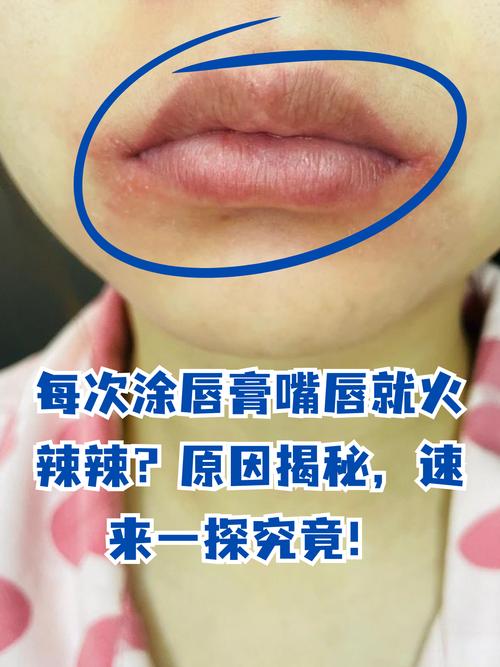 涂口红有什么危害