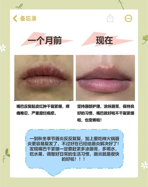 涂口红有什么危害