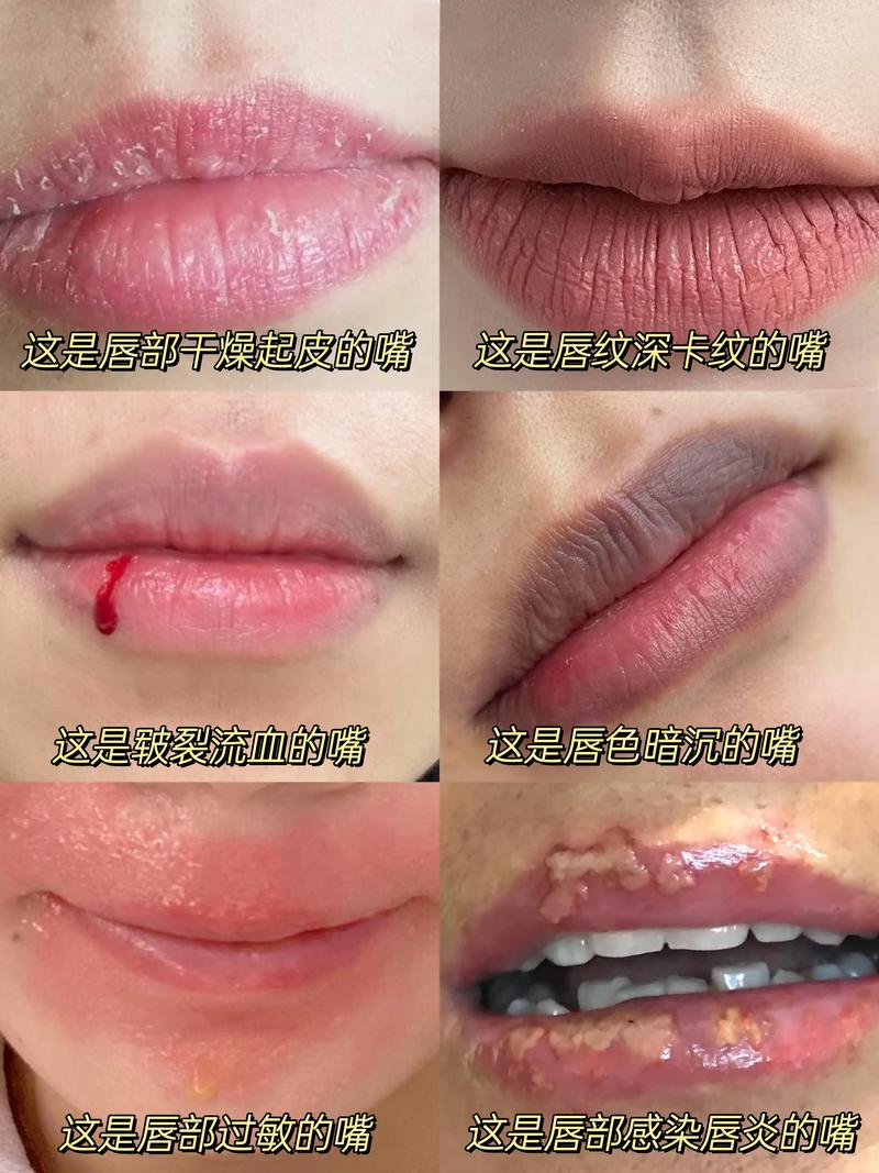 涂口红有什么危害