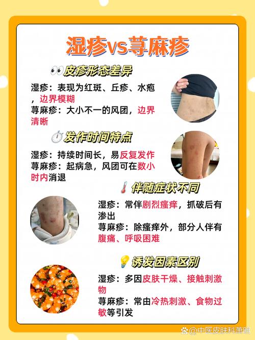 身上痒是什么引起的