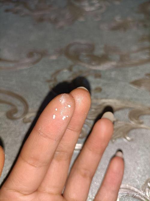 什么洗面奶里面有颗粒