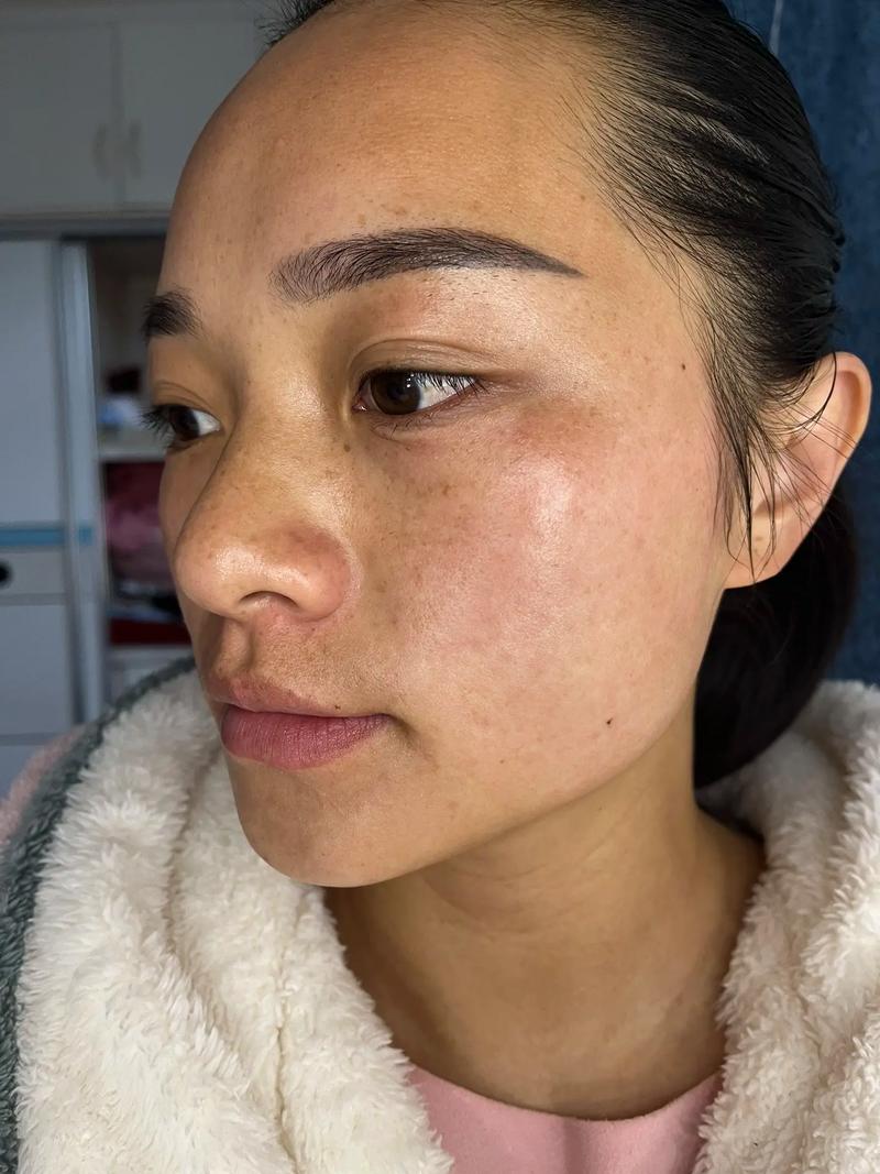 洗面奶用了皮肤变黑了