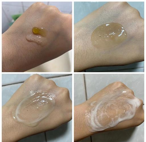 洗面奶用了皮肤变黑了