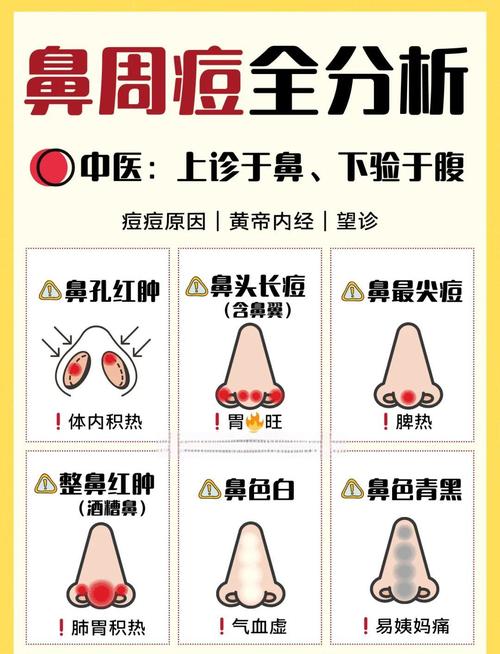 鼻子为什么会长痘痘