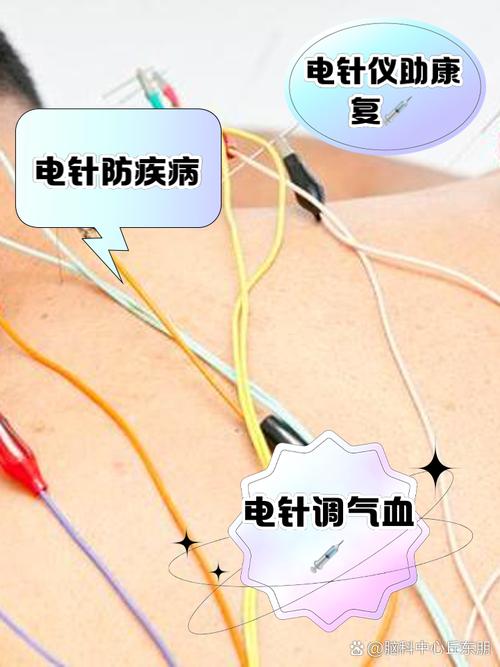 电疗有什么危害