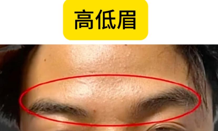 为什么眉毛不对称