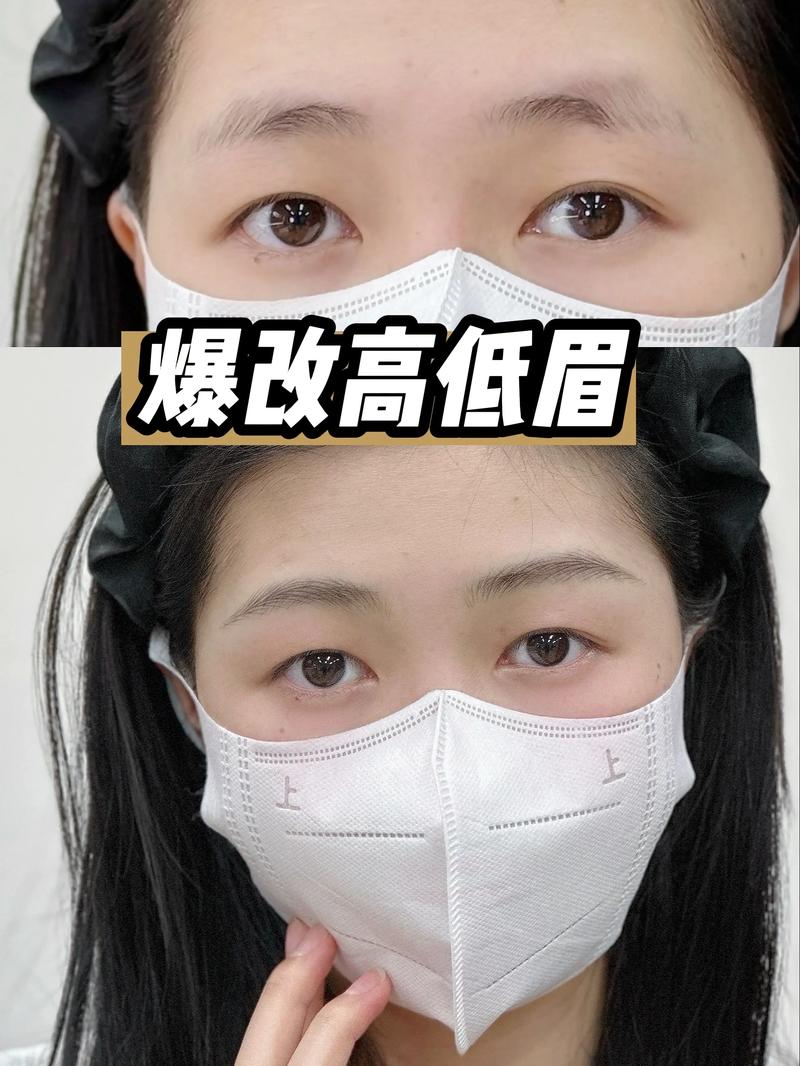 为什么眉毛不对称