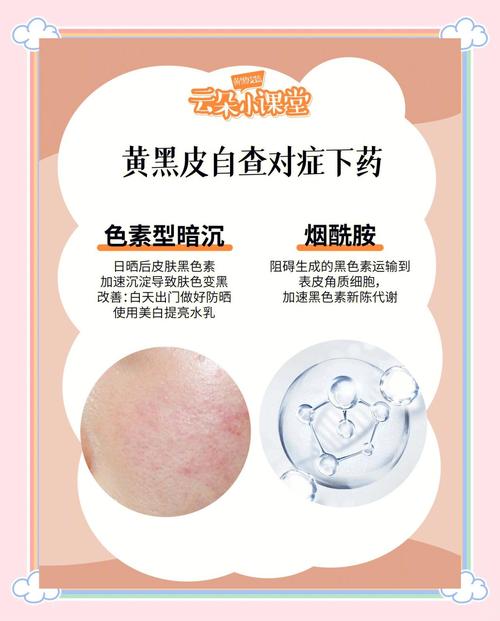 皮肤黑黄是什么原因