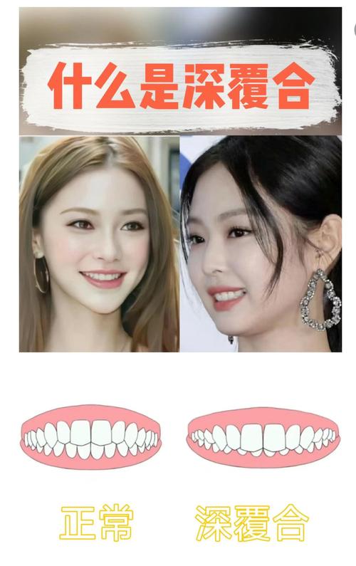 深覆合什么意思