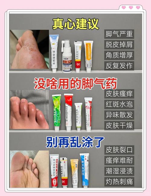 治脚气有什么偏方