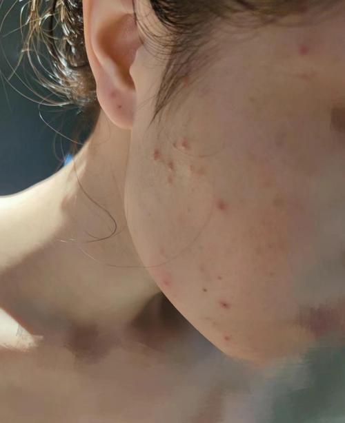 哪款护肤品适合20岁用