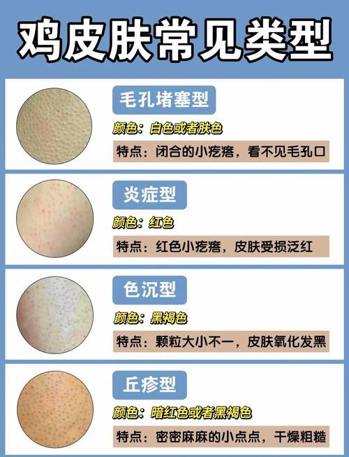 为什么会长鸡皮肤