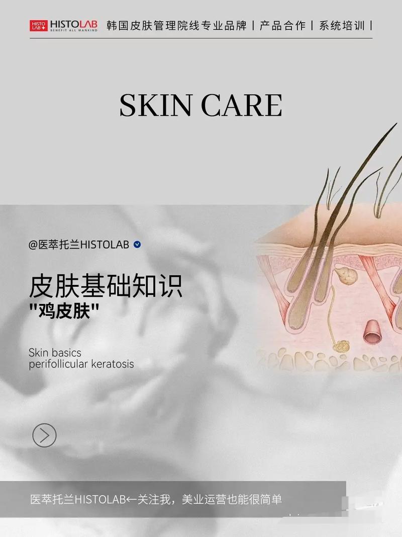 为什么会长鸡皮肤