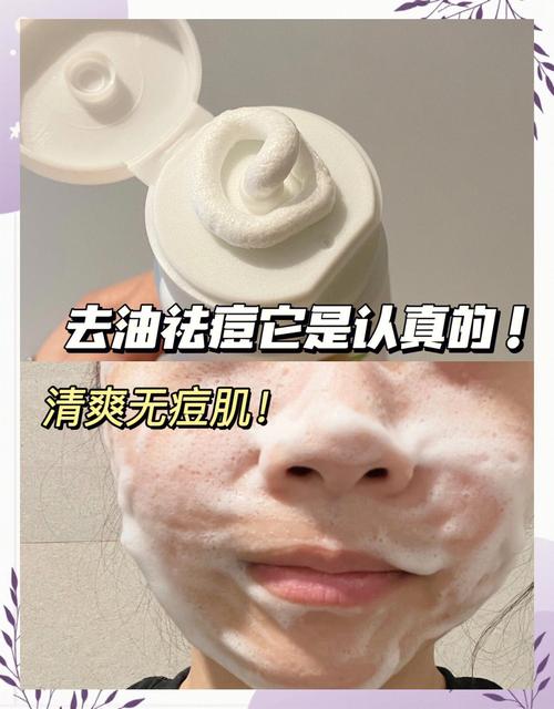 脸上有豆豆能用洗面奶