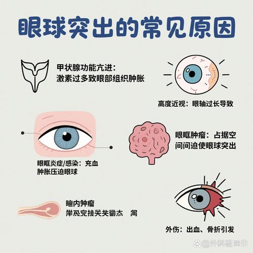 什么是突眼