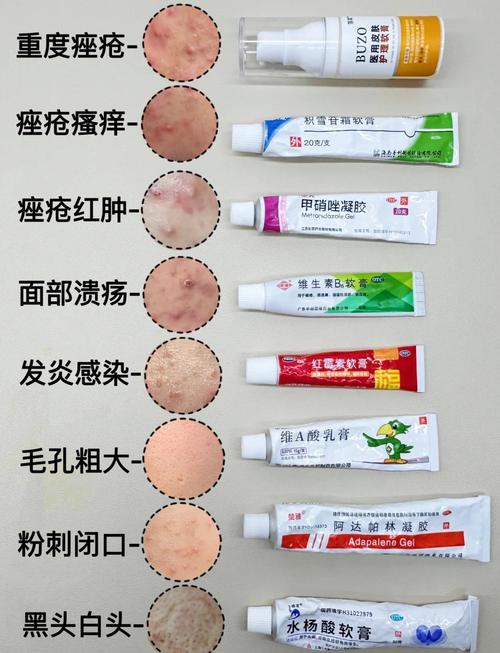 长痘用什么护肤品好