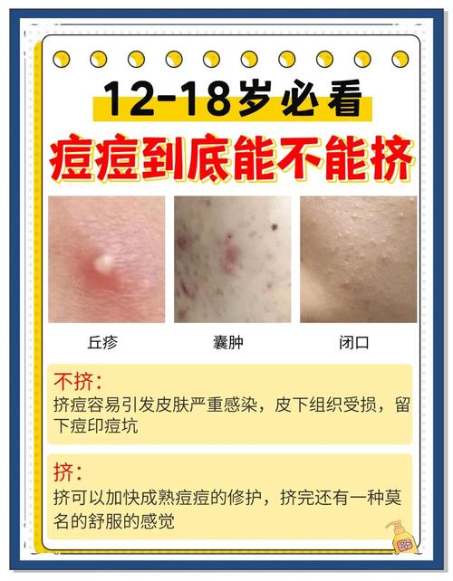 痘痘用什么方法