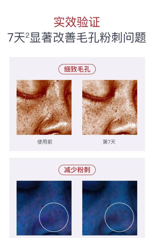 脸上有毛孔用什么护肤品