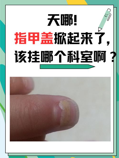 指甲属于什么科