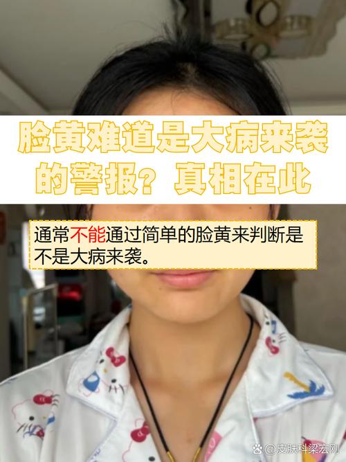 为什么会脸色发黄