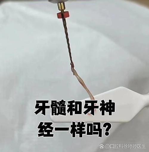牙神经是什么样的