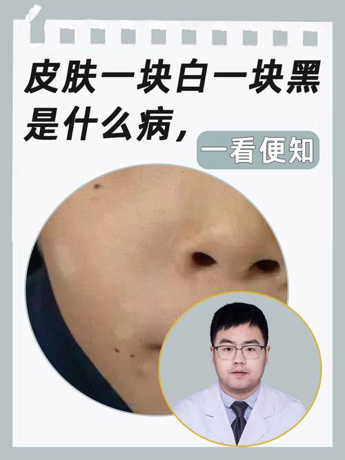 为什么脸白脖子黑