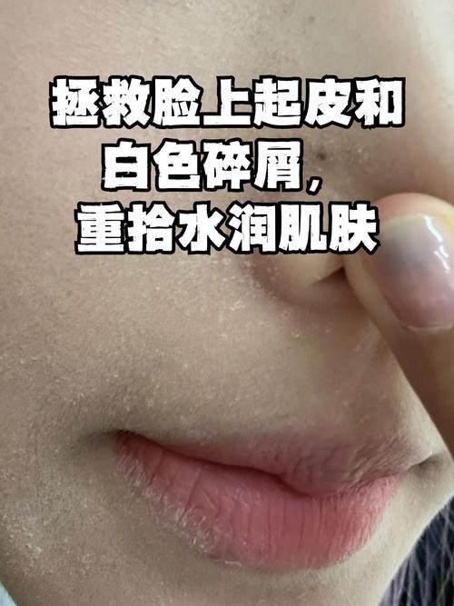 脸起皮用什么护肤品