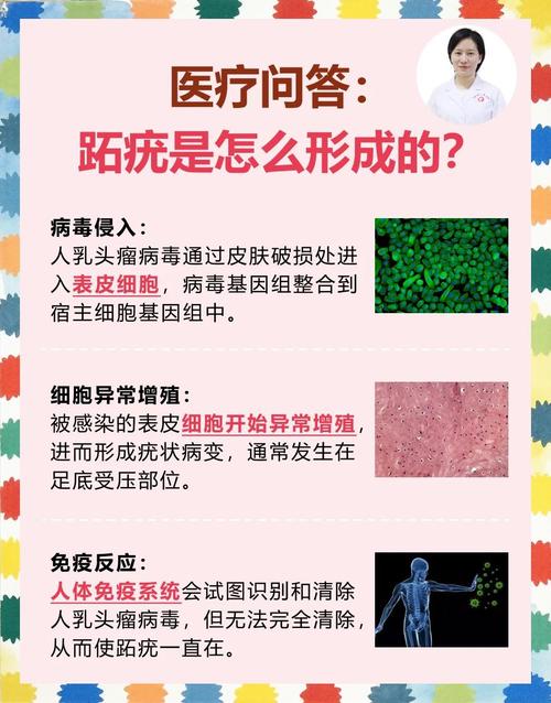 长痦子是什么原因