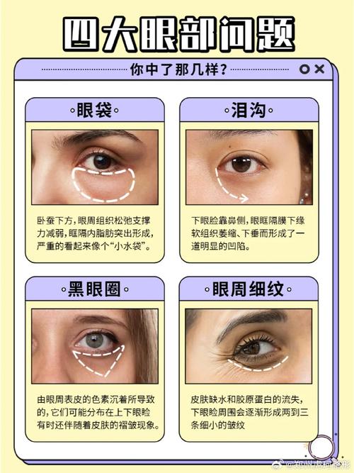 眼皮松弛什么原因