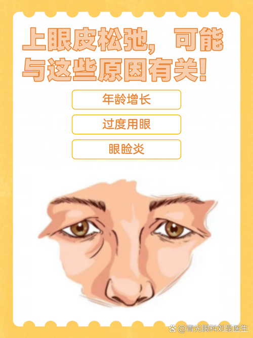 眼皮松弛什么原因