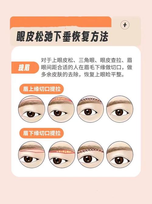 眼皮松弛什么原因