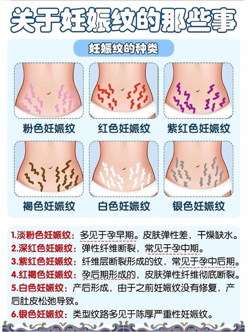 减肥为什么会有孕生纹