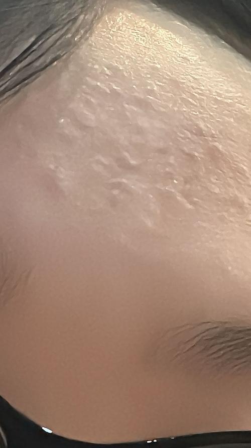 资生堂泡沫洗面奶过敏