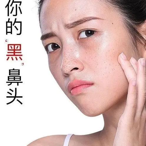 收缩毛孔 鼻头的护肤品