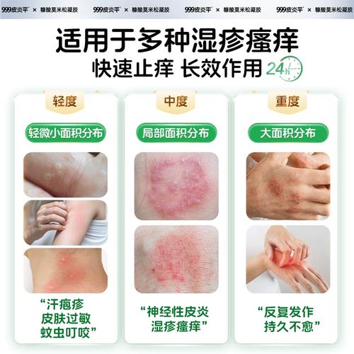 过敏了 能用什么护肤品